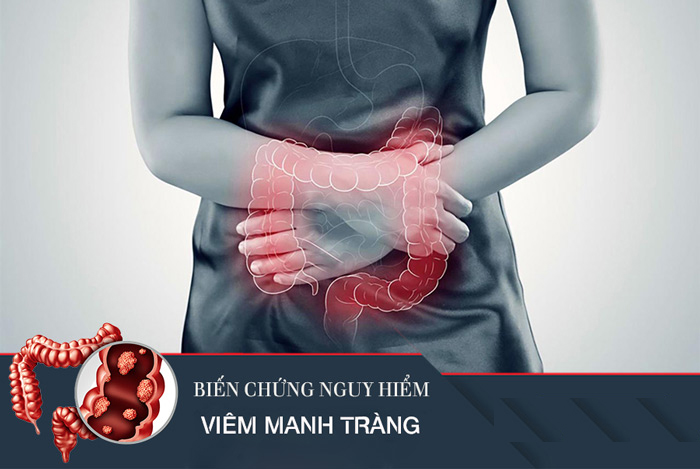 bien-chung-nguy-hiem-viem-manh-trang-1