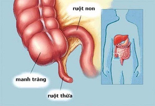 viem-manh-trang-co-nguy-hiem-khong-1