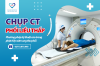 Chụp CT phổi liều thấp - phát hiện sớm ung thư phổi