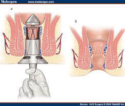 tri-longo-2